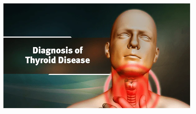 Ayurveda & Thyroid Health (Ayurveda on Root Causes of Thyroid, Diagnosis of Thyroid and Thyroid Diet) - Image 6