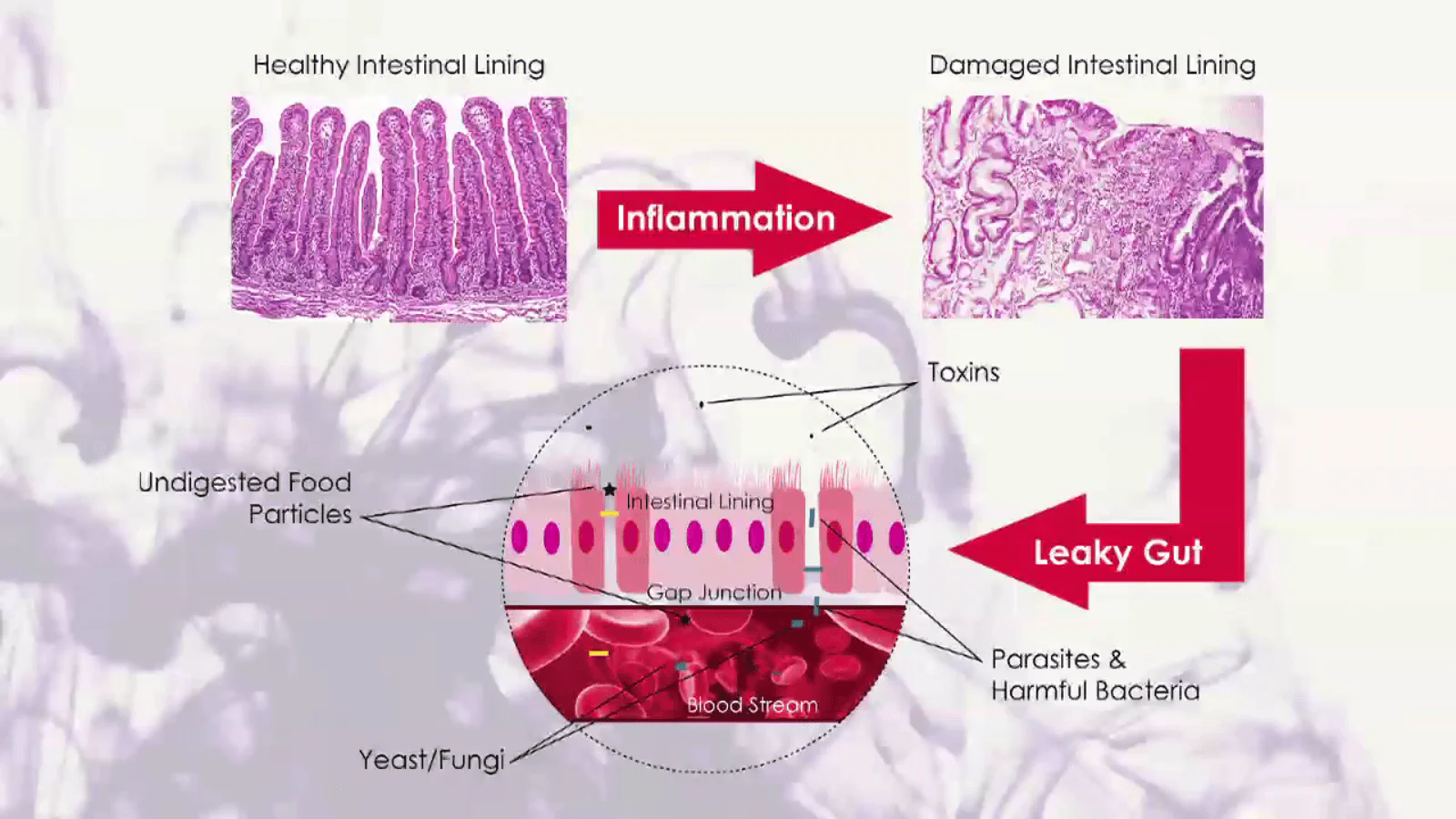 Ayurveda and Auto-Immune Diseases (Ayurveda on Symptoms, Root Causes and Recovery from Thyroid Disorders, IBD, Celiac Disease and Skin Ailments like Eczema) - Image 7